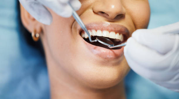 Best Walk-In Emergency Dentist in Crestview, FL